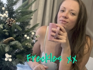 Freckles_xx